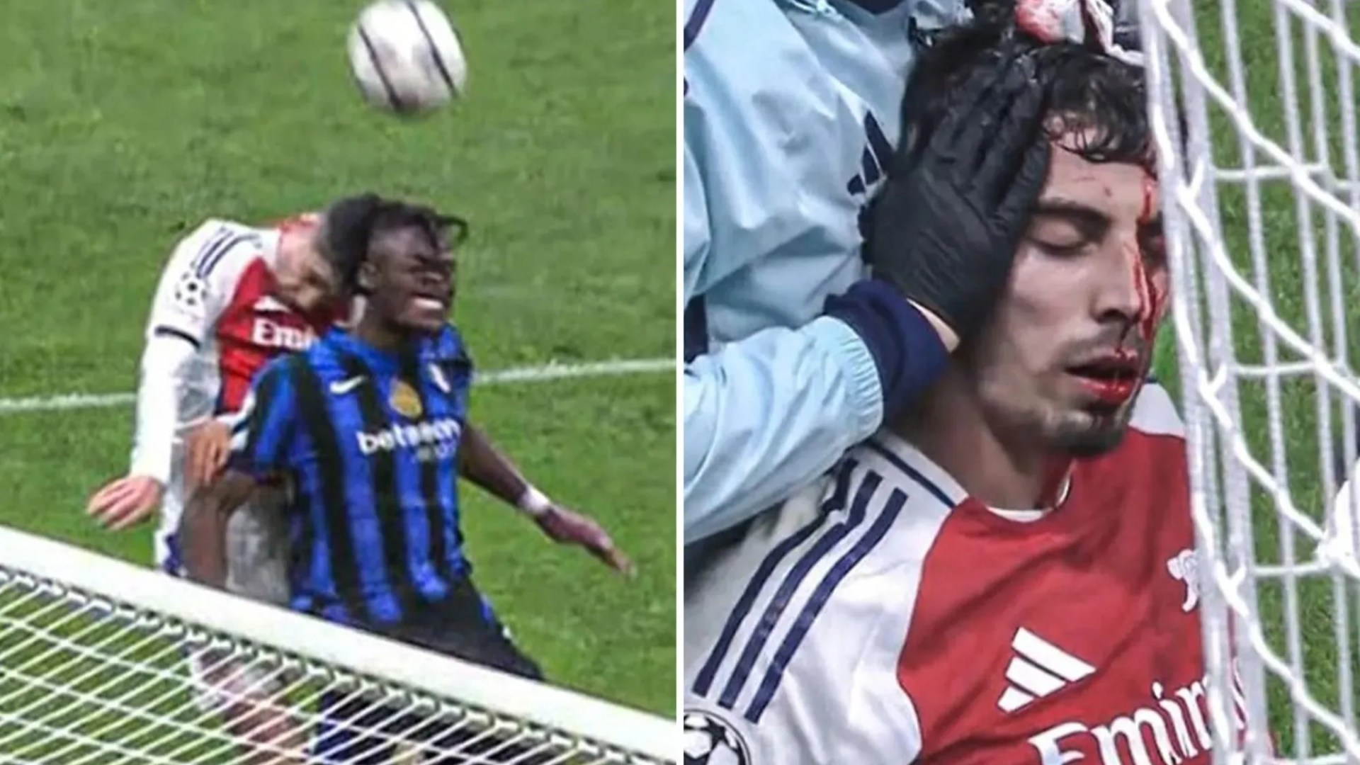 Kai Havertz left with blood pouring from his head after Arsenal star's sickening clash of heads