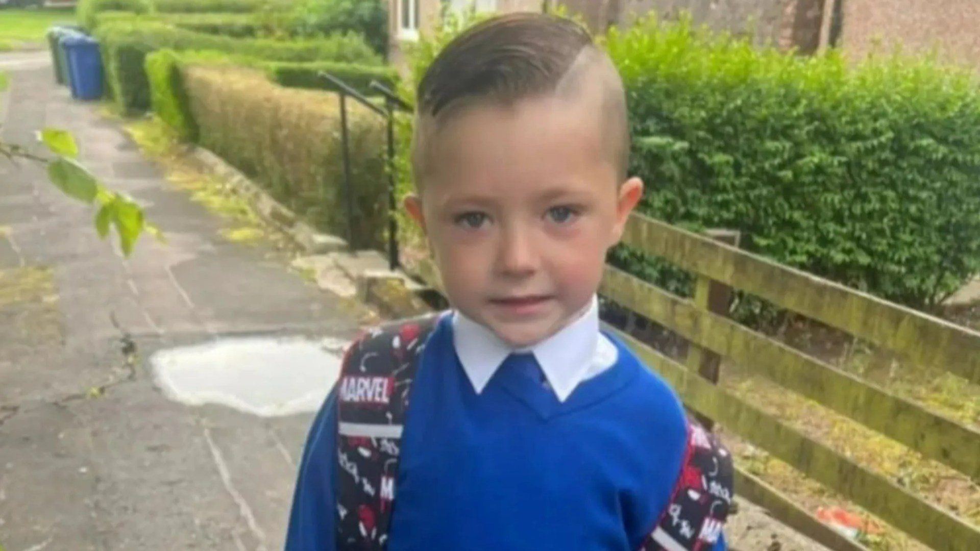 Five-year-old boy mauled by XL Bully as horror attack leaves him needing facial reconstruction