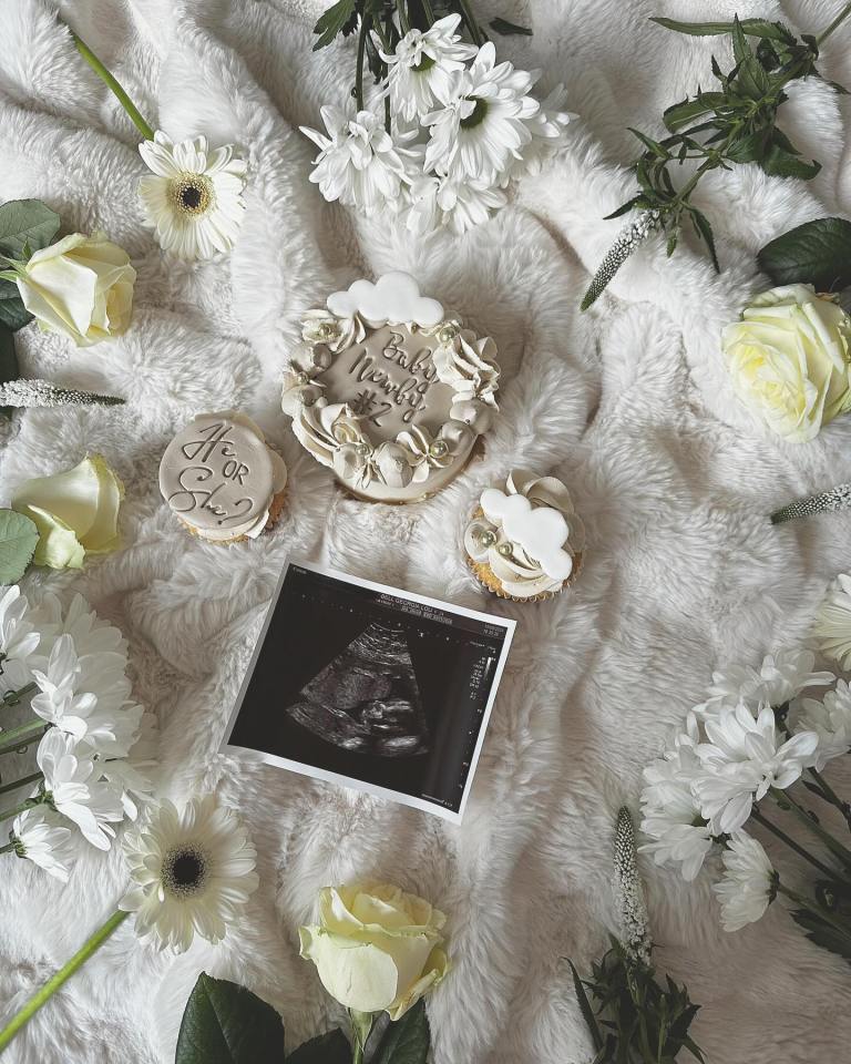 Georgia and Josh shared a snap of her scan as part of the announcement