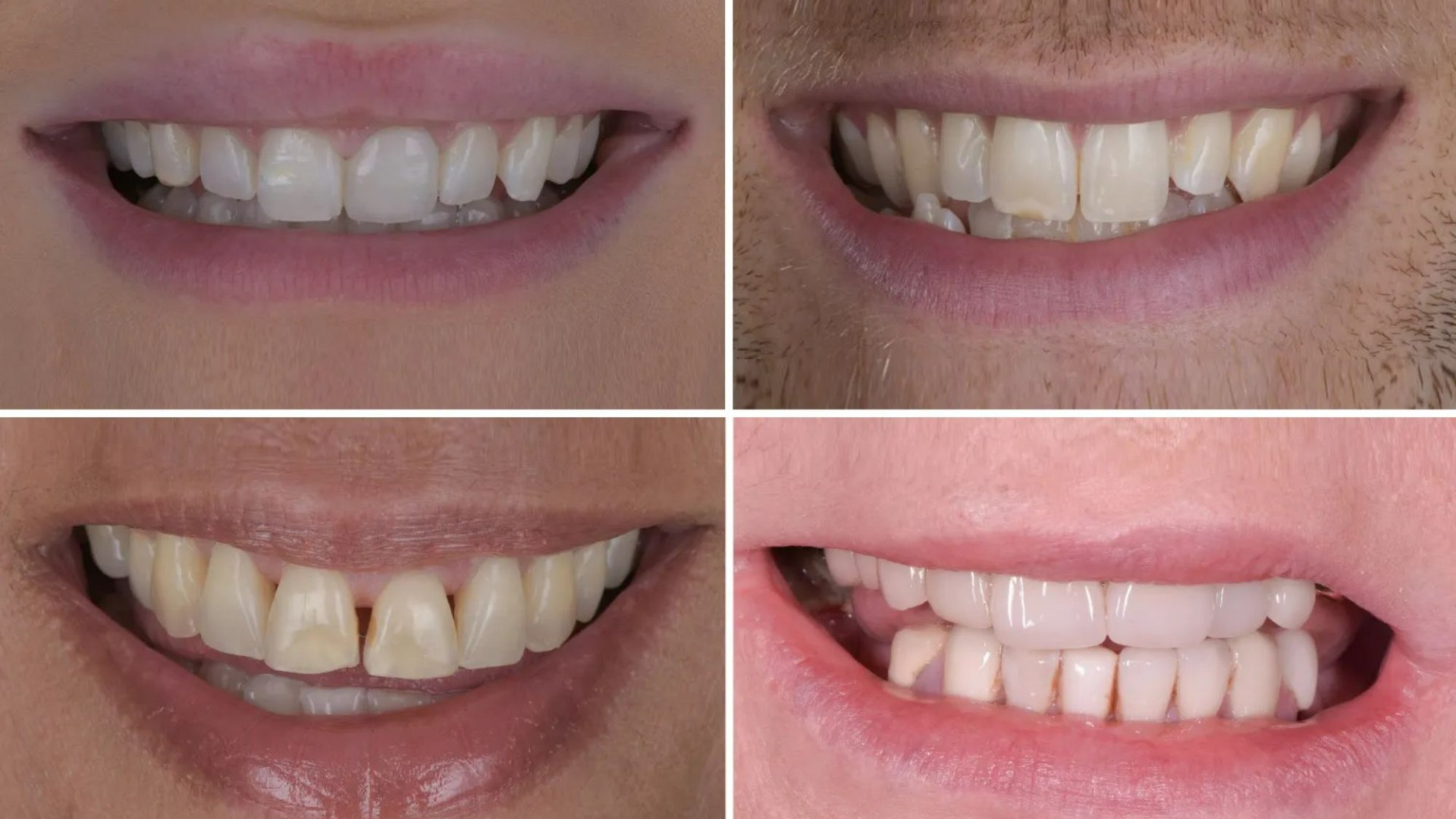 Time-lapse video reveals how your teeth will change in each decade of life