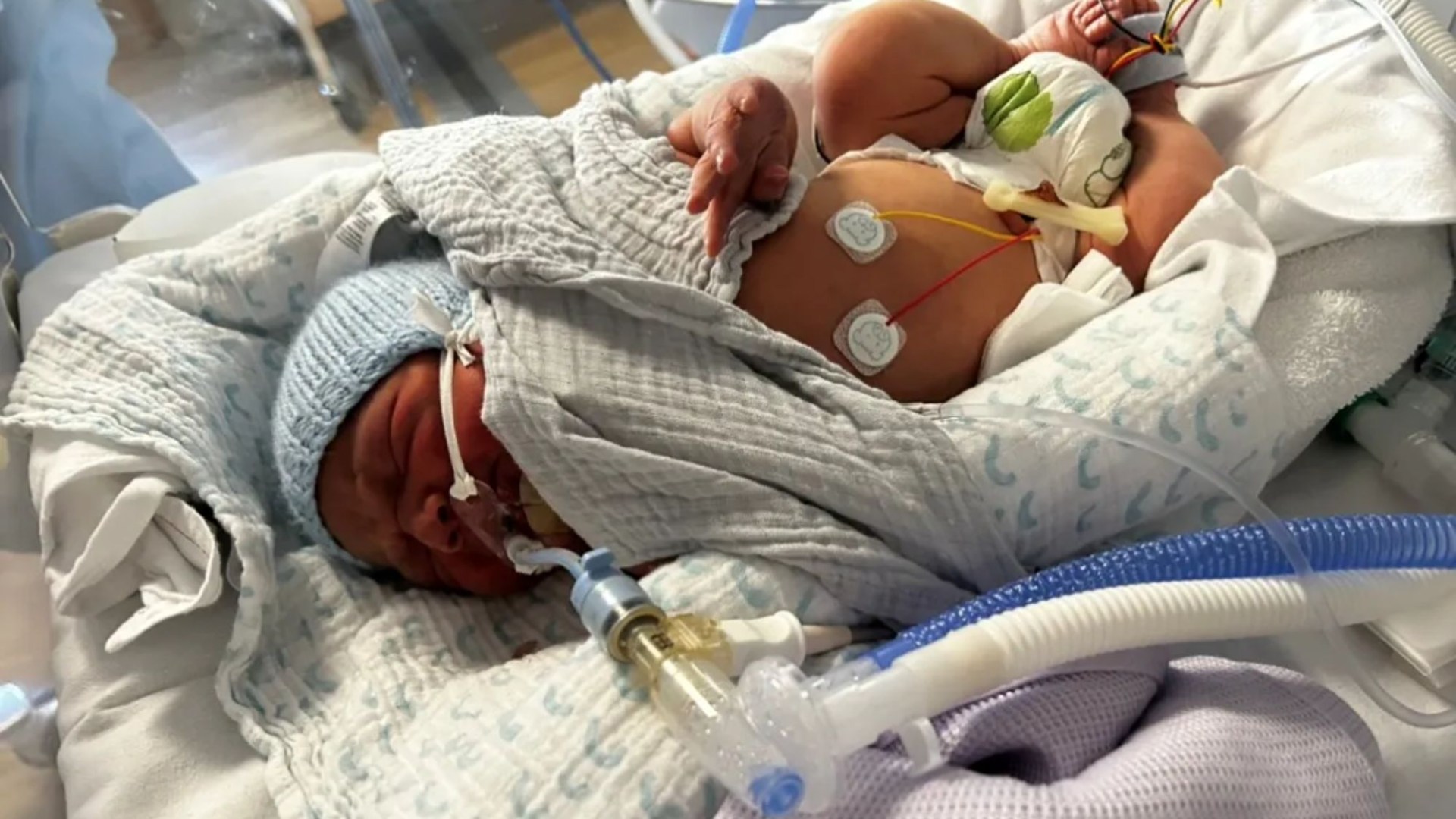 Mum recalls terrifying moment 'healthy' newborn Blake started vomiting blood - and bleeding from his nose and bottom