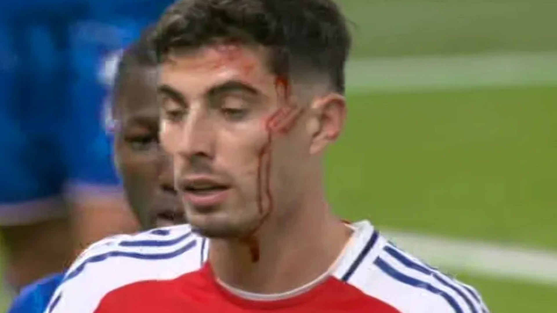 Kai Havertz left covered in blood as horror head wound opens back up with Arsenal star forced off pitch against Chelsea