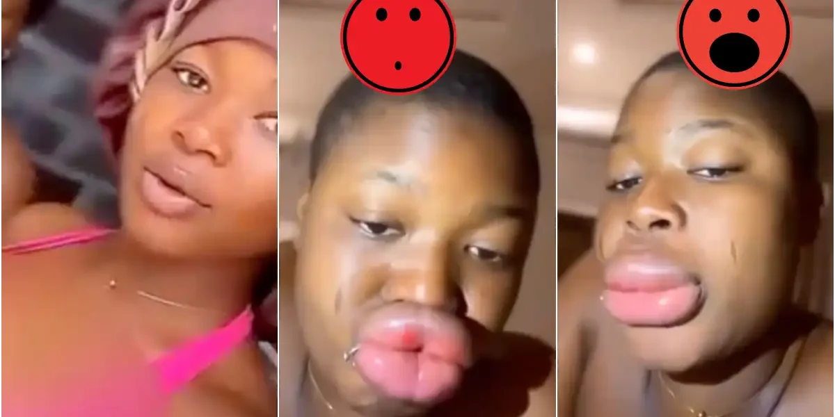 Lady cries out over sudden lips transformation after a fun day