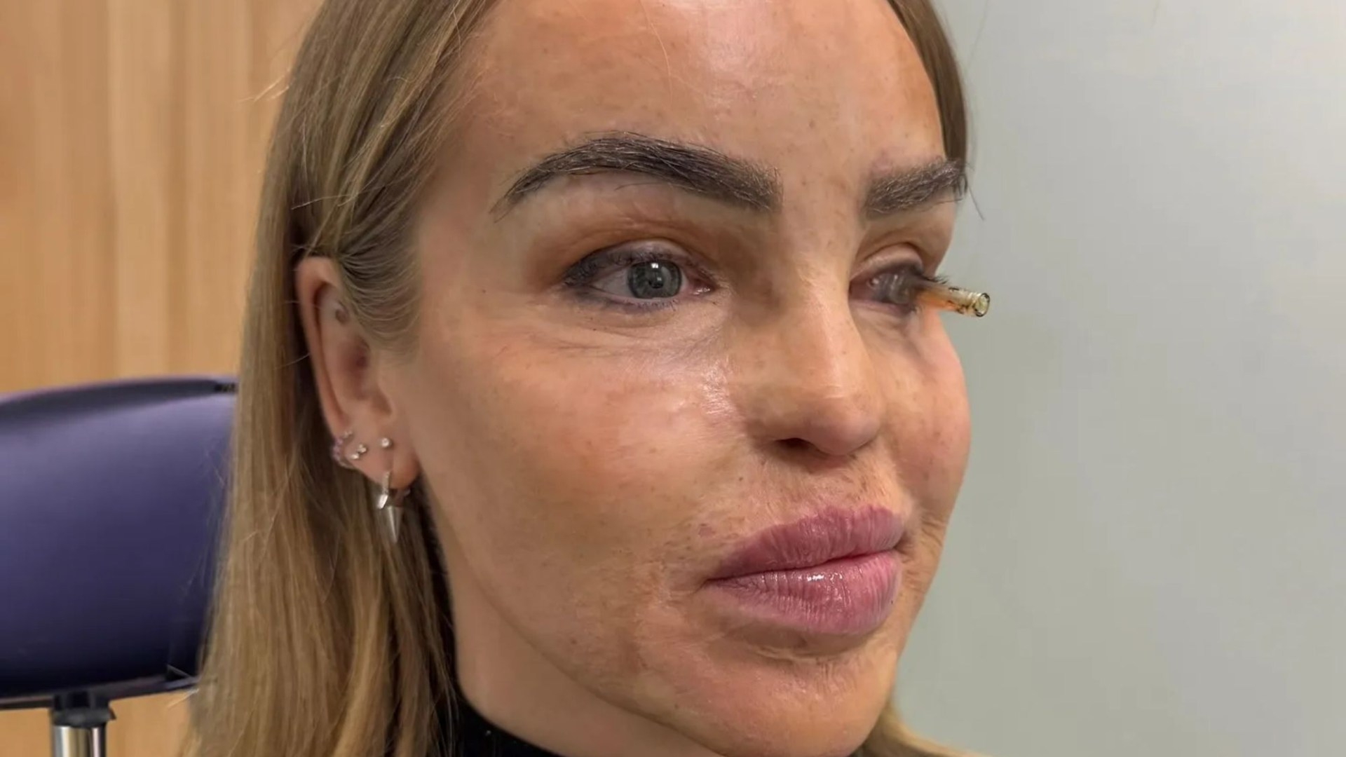 Katie Piper shares emotional health update after eye surgery as she says she’s finally ‘reached the end of the road’