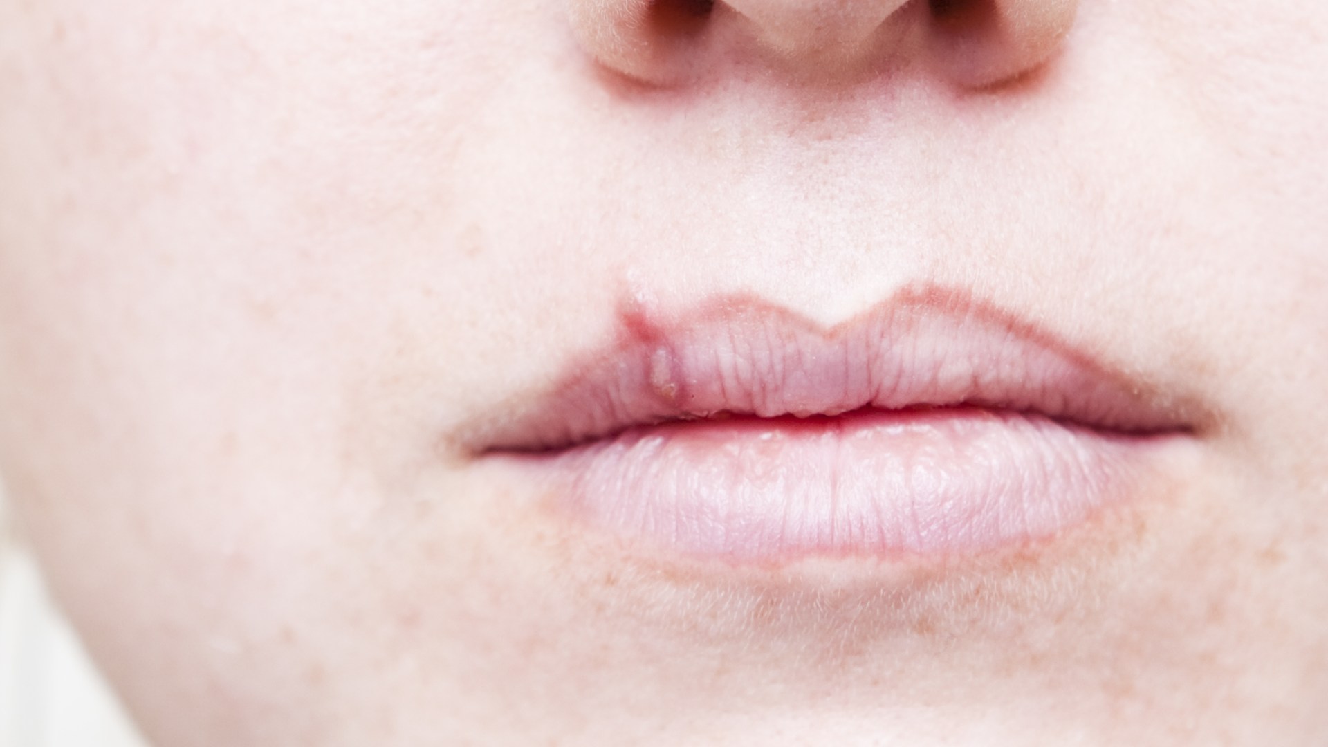 I'm worried that my partner’s cold sore is a sign he’s been cheating - should I get checked?